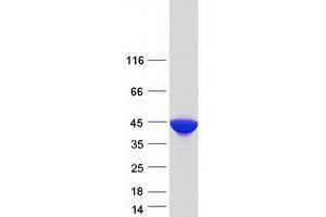 Western Blotting (WB) image for Aldolase A, Fructose-Bisphosphate (ALDOA) (Transcript Variant 2) protein (Myc-DYKDDDDK Tag) (ABIN2714555)