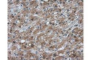 Immunohistochemical staining of paraffin-embedded liver tissue using anti-NIT2 mouse monoclonal antibody. (NIT2 antibody)