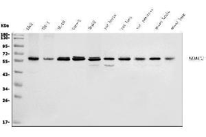 Western blot analysis of HDAC2 using anti-HDAC2 antibody (ABIN7601564).