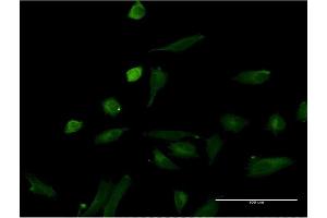 Immunofluorescence (IF) image for anti-Interleukin 1 alpha (IL1A) (AA 172-271) antibody (ABIN516992)
