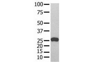 GST Tag antibody used in western blot with recombinant protein (GST-Tag antibody)
