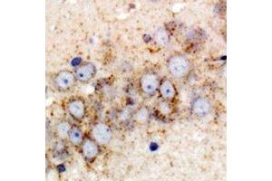 Immunohistochemical analysis of GPI staining in rat brain formalin fixed paraffin embedded tissue section. (GPI antibody)