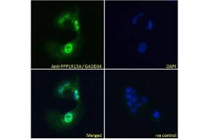 ICC/IF testing of fixed and permeabilized human HepG2 cells with GADD34 antibody (green) at 10ug/ml and DAPI nuclear stain (blue). (GADD34 antibody)