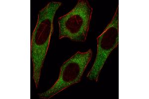 Fluorescent image of Hela cell stained with IRS2 Antibody . (IRS2 antibody  (C-Term))