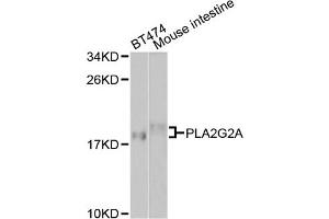 Western blot analysis of extracts of various cell lines, using PLA2G2A antibody.