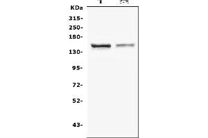 Western blot analysis of CRB1 using anti-CRB1 antibody (ABIN6719658). (CRB1 antibody)
