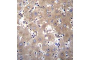 Formalin fixed, paraffin embedded human liver tissue stained with SIX5 Antibody  followed by peroxidase conjugation of the secondary antibody and DAB staining. (Six5 antibody  (Middle Region))