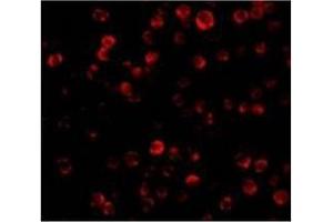 Immunofluorescence of RAIDD in Hela cells with RAIDD antibody at 20 µg/ml. (CRADD antibody  (Middle Region))