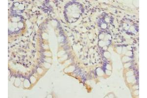 Immunohistochemistry of paraffin-embedded human small intestine tissue using ABIN7154822 at dilution of 1:100 (HDHD3 antibody  (AA 1-251))