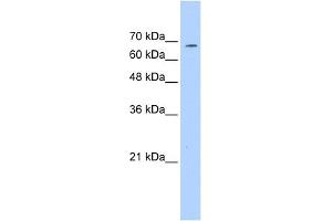 WB Suggested Anti-GP1BA Antibody Titration:  0. (CD42b antibody  (C-Term))