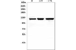 Western blot analysis of NLRP2 using anti-NLRP2 antibody (ABIN6719345). (NLRP2 antibody  (AA 9-190))
