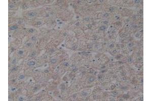 Immunohistochemistry (IHC) image for anti-NF-kappa-B inhibitor beta (NFKBIB) (AA 85-332) antibody (ABIN7442534)