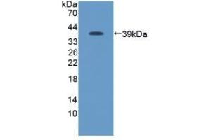 Detection of Recombinant Protein RPA096Ca01 with GST-tag using Anti-Glutathione S Transferase (GST) Tag Polyclonal Antibody (GST antibody  (AA 1-218))