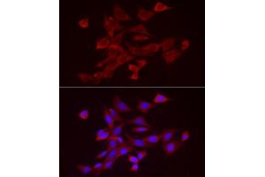 Immunofluorescence analysis of NIH/3T3 cells using  Rabbit pAb (ABIN7265439) at dilution of 1:25 (40x lens).