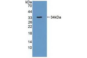 Detection of Recombinant DYNC1H1, Human using Polyclonal Antibody to Dynein, Cytoplasmic 1, Heavy Chain 1 (DYNC1H1) (DYNC1H1 antibody  (AA 20-285))