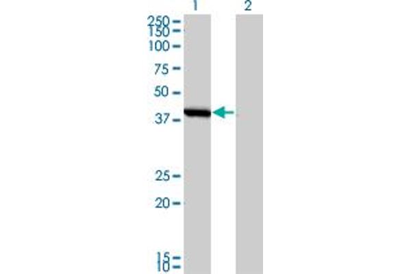 SMS anticorps  (AA 1-366)