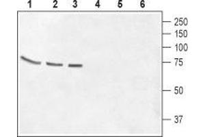 Western blot analysis of rat brain membrane (lanes 1 and 4), mouse brain membrane (lanes 2 and 5) and Human CCF-STGI  brain astrocytoma cell lysate (lanes 3 and 6): - 1-3. (GABRQ antibody  (Extracellular, N-Term))