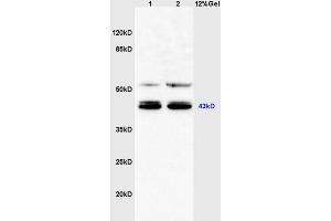 Mouse heart lysates probed with Anti C3orf21/XXYLT1 Polyclonal Antibody, Unconjugated (ABIN1385794) at 1:200 in 4 °C. (XXYLT1 antibody  (AA 120-165))