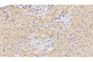 Detection of MUC5AC in Mouse Cardiac Muscle Tissue using Polyclonal Antibody to Mucin 5 Subtype AC (MUC5AC) (MUC5AC antibody  (AA 430-549))