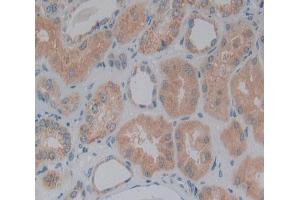 Figure. (DBN1 antibody  (AA 3-134))