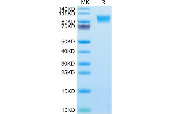 MCAM Protein (AA 24-559) (His tag)