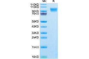 Human MUC18/CD146 on Tris-Bis PAGE under reduced condition. (MCAM Protein (AA 24-559) (His tag))