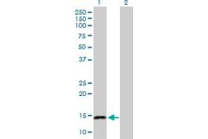 Western Blot analysis of NFATC2IP expression in transfected 293T cell line by NFATC2IP MaxPab polyclonal antibody.