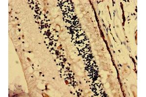 Immunohistochemistry analysis of human eye tissue using ABIN7145466 at dilution of 1:100 (CRYbA4 antibody  (AA 2-196))