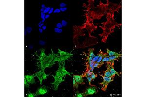 Immunocytochemistry/Immunofluorescence analysis using Mouse Anti-TARP Gamma2/4/8 (Stargazin) Monoclonal Antibody, Clone S245-36 . (Stargazin antibody  (AA 203-323) (APC))