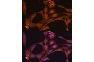 Immunofluorescence analysis of NIH-3T3 cells using CLOCK Rabbit mAb (ABIN7266414) at dilution of 1:100 (40x lens). (CLOCK antibody)