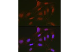 Immunofluorescence analysis of U2OS cells using RBL2 Rabbit pAb (ABIN7269943) at dilution of 1:50 (40x lens). (p130 antibody  (AA 100-200))