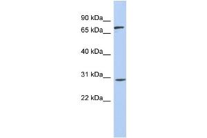 WB Suggested Anti-ZNF131 Antibody Titration:  0. (ZNF131 antibody  (Middle Region))