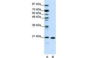 Western Blotting (WB) image for anti-Ribosomal Protein L9 (RPL9) antibody (ABIN2462050) (RPL9 antibody)