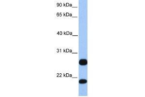 WB Suggested Anti-C1orf63 Antibody Titration:  0. (C1orf63 antibody  (C-Term))