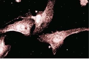 Immunofluorescent staining of endothelial cells. (AKAP5 antibody  (AA 180-427))