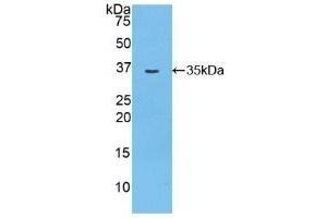 Detection of Recombinant MYO1D, Rat using Polyclonal Antibody to Myosin ID (MYO1D) (Myosin ID antibody  (AA 512-788))