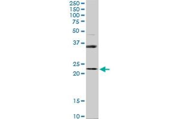 RAB31 antibody  (AA 96-195)