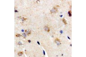Immunohistochemical analysis of Interferon lambda-3 staining in rat brain formalin fixed paraffin embedded tissue section. (IL28B antibody)