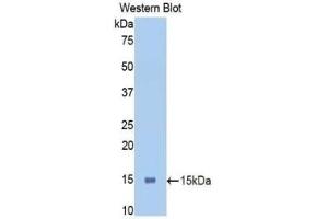 Detection of Recombinant PIGR, Mouse using Polyclonal Antibody to Polymeric Immunoglobulin Receptor (PIGR) (PIGR antibody  (AA 463-563))