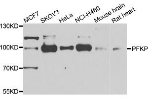 Western blot analysis of extracts of various cell lines, using PFKP antibody (ABIN5975671) at 1/1000 dilution. (PFKP antibody)