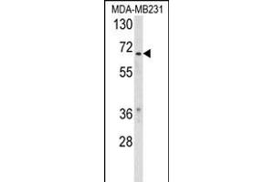 Western blot analysis of RXRB Antibody (Center) (ABIN653727 and ABIN2843034) in MDA-M cell line lysates (35 μg/lane). (Retinoid X Receptor beta antibody  (AA 256-284))