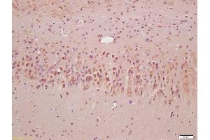 Formalin-fixed and paraffin embedded rat brain labeled with Anti-SQSTM1 Polyclonal Antibody, Unconjugated (ABIN682153) at 1:200, followed by conjugation to the secondary antibody and DAB staining (SQSTM1 antibody  (AA 51-150))