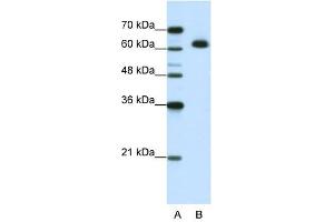 MGC42174 antibody used at 1. (DIS3L2 antibody  (N-Term))
