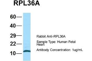 Host: Rabbit  Target Name: RPL36A  Sample Tissue: Human Fetal Heart  Antibody Dilution: 1. (RPL36AL antibody  (C-Term))