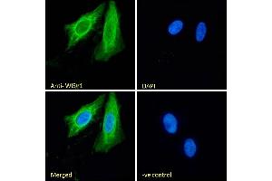 (ABIN238610) Immunofluorescence analysis of paraformaldehyde fixed U2OS cells, permeabilized with 0. (WISP1 antibody  (C-Term))