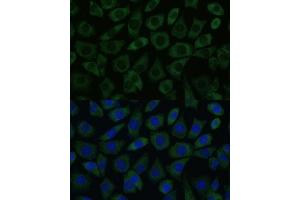 Immunofluorescence (IF) image for anti-DEAD (Asp-Glu-Ala-Asp) Box Polypeptide 6 (DDX6) (C-Term) antibody (ABIN7266704)