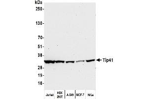 Western Blotting (WB) image for anti-TIP41-like protein (TIPRL) (C-Term) antibody (ABIN7453900)