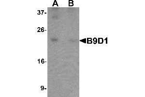 Western blot analysis of B9D1 in 293 cell lysate with B9D1 antibody at 1 µg/mL in (A) the absence and (B) the presence of blocking peptide. (B9D1 antibody  (C-Term))