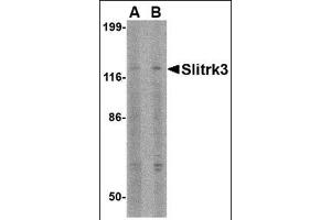 Western blot analysis of Slitrk3 in SK-N-SH cell lysate with this product at (A) 0. (SLITRK3 antibody  (C-Term))