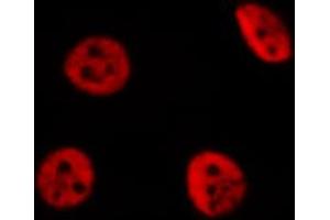 ABIN6274259 staining Hela cells by IF/ICC. (YAP1 antibody  (Internal Region))